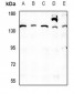 Anti-QSK Antibody