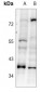 Anti-SRSF8 Antibody