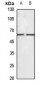 Anti-CaMKK beta Antibody