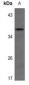 Anti-IGFBP1 Antibody