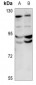 Anti-DPD Antibody