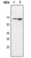 Anti-CD316 Antibody