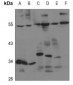 Anti-EDG5 Antibody