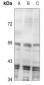 Anti-Inhibin beta C Antibody