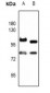 Anti-FOXO1 (pS256) Antibody