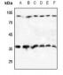 Anti-CD107b Antibody