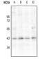 Anti-AT1 Antibody