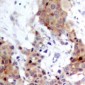 Anti-FOXO1/3 Antibody