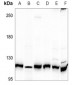 Anti-AXL Antibody