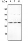 Anti-STEAP2 Antibody