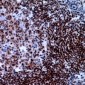 Anti-XRCC3 Antibody