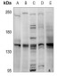 Anti-MYBPC3 Antibody