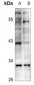 Anti-KLF13 (AcK166) Antibody