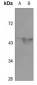 Anti-MEF2A (AcK403) Antibody