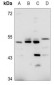 Anti-CD240d Antibody