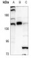 Anti-GLI1 Antibody