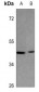 Anti-IDH3 gamma Antibody