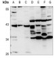 Anti-Apolipoprotein A5 Antibody