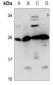 Anti-CIDEB Antibody