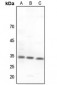 Anti-CNOT7 Antibody