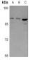 Anti-ABCF1 Antibody