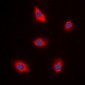 Anti-EPS8L1 Antibody