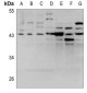 Anti-LPAAT gamma Antibody