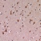 Anti-PDCD12 Antibody