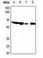 Anti-PDCD12 Antibody