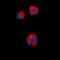 Anti-AAK1 Antibody