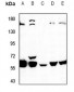 Anti-K Cadherin Antibody