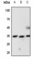 Anti-Latexin Antibody