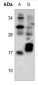 Anti-TCL-1A Antibody