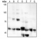 Anti-CD126 Antibody