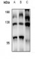 Anti-RFC1 Antibody