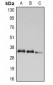 Anti-UCP2 Antibody