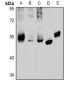 Anti-GABRB2 Antibody