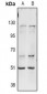 Anti-ITPKA Antibody
