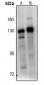 Anti-BUB1B Antibody