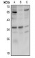 Anti-FR beta Antibody