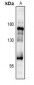 Anti-IRS2 Antibody