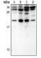 Anti-IL-15 Antibody