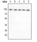 Anti-FOXO3 Antibody