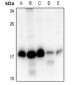 Anti-RPS15 Antibody