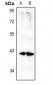 Anti-Annexin A10 Antibody