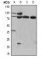 Anti-Beta-catenin (pY670) Antibody