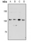 Anti-KSR2 Antibody