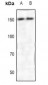 Anti-ROCK2 Antibody