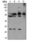 Anti-BLK (pY389) Antibody