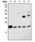 Anti-RAP2B Antibody